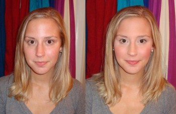 Before and After