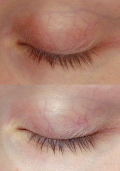 Bare Lashes Before and After